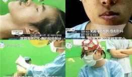 吃瓜下颚破皮视频,网友直呼太痛了